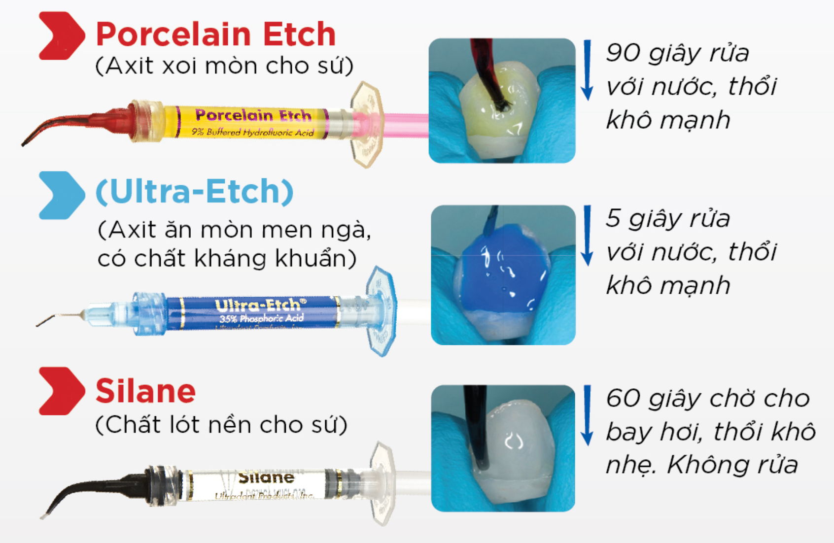 Các bước sử dụng bộ vật liệu gắn mặt dán sứ veneer của hãng Ultradent🌱NHA KHOA MALL🌱